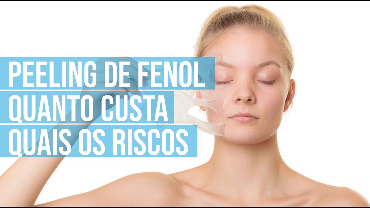 Peeling de Fenol: Quanto custa, Preço e quais os riscos? - YouTube
