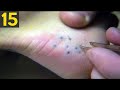 15 MOST Painful Stings in Nature