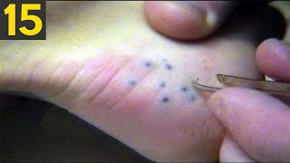 15 MOST Painful Stings in Nature