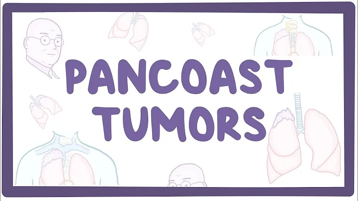 Pancoast tumors - causes, symptoms, diagnosis, tre...