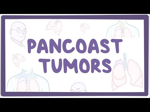 Pancoast tumors - causes, symptoms, diagnosis, treatment, pathology