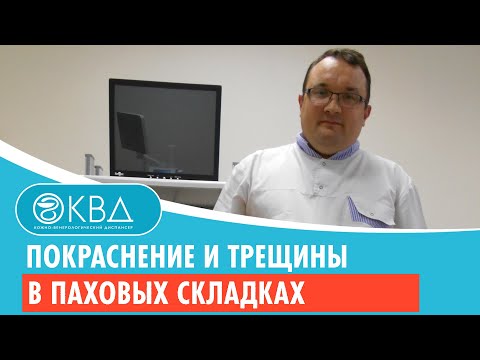 😐 Покраснение и трещины в паховых складках. Клинический случай №323