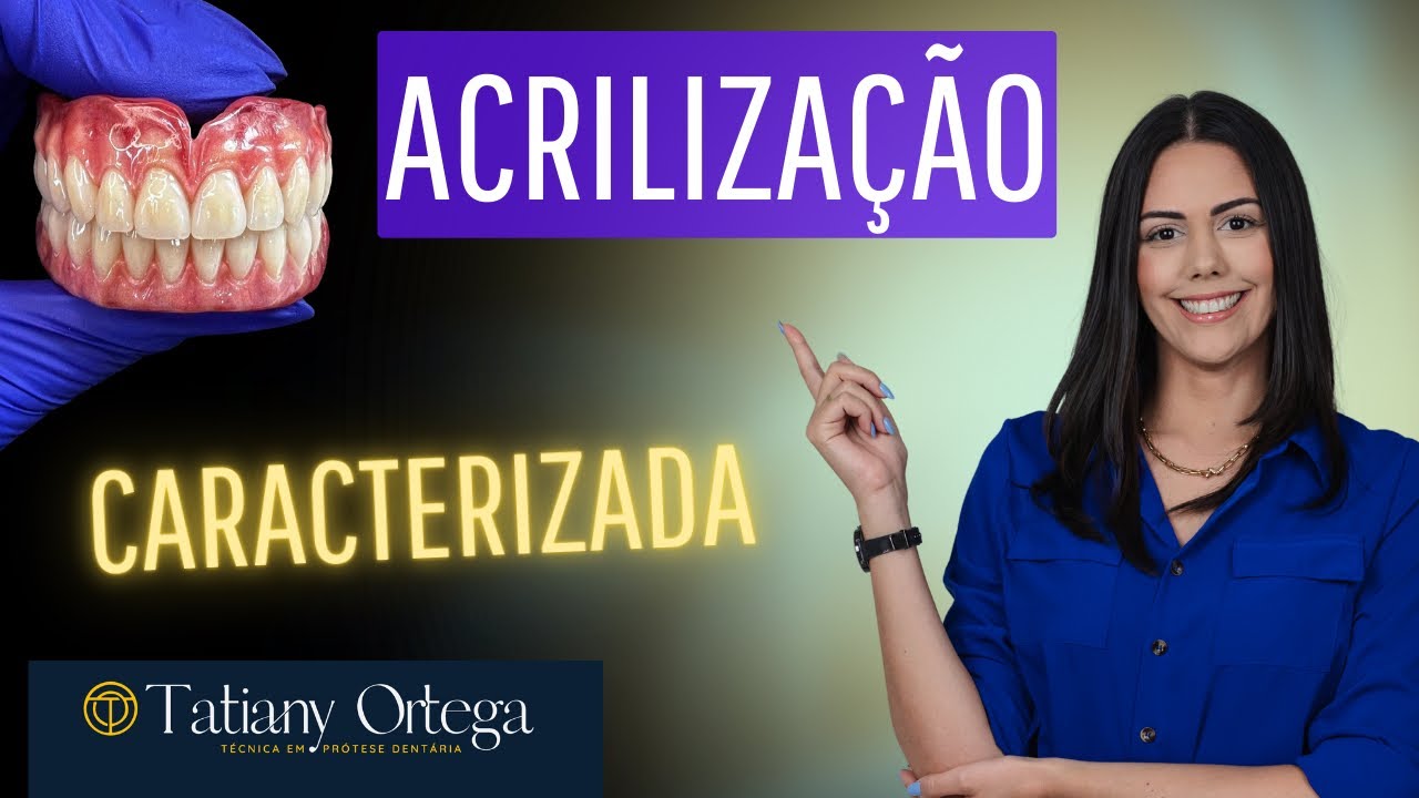 Acrilização de prótese total caracterização natural