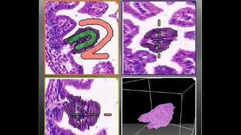 3DHISTECH - Segmentation in 3DView software