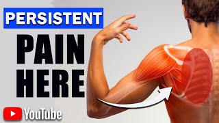 Persistent Rhomboid Pain (Best Exercises & Posture Modifications)