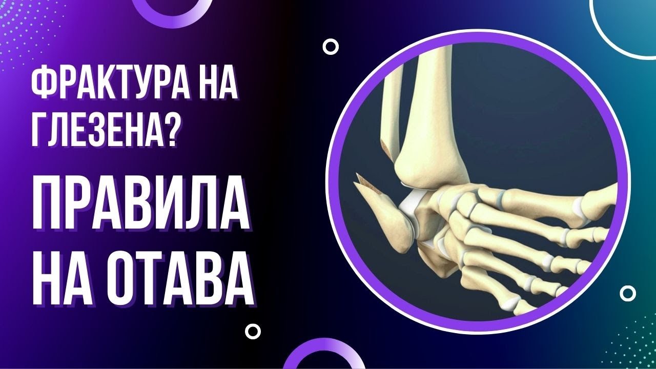Как да изследваме за фрактура на глезена? Правила на Отава.