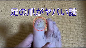 足の爪 Youtube 足の爪 Youtube