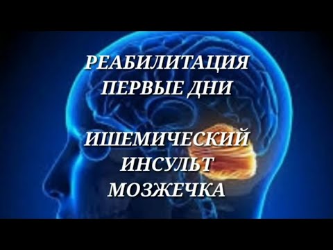 Ишемический инсульт мозжечка! Реабилитация! Первые дни!