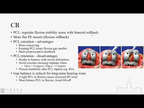 무릎 인공관절 수술의 원칙 및 방법 1부 - Basic principles of total knee arthroplasty