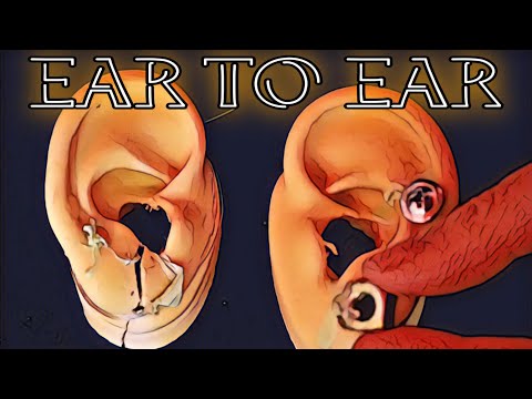 ASMR POP : RETIRANDO SEU ALARGADOR (binaural)