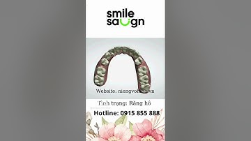 Phác đồ Niềng răng hô - SmileSalign Việt Nam 1