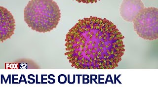 Measles outbreak: More than dozen states reported cases in 2024