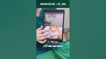 Bạn khách thích dáng mũi cao nhẹ nhàng nên chọn combo nâng mũi CẤU TRÚC + cắt_cánh #shorts