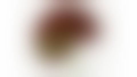 Frozen Calot -how to dissect - Laparoscopic Cholecystectomy