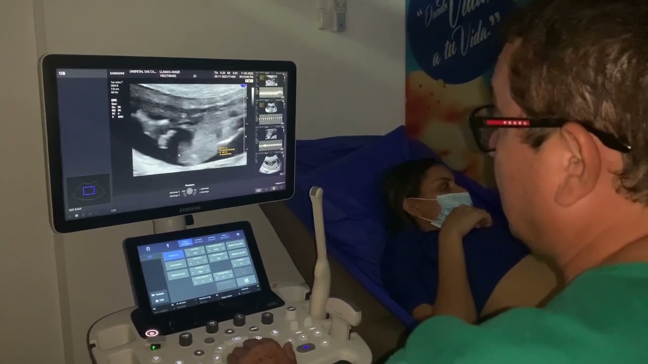 ECOGRAFÍA TRANSLUCENCIA NUCAL
