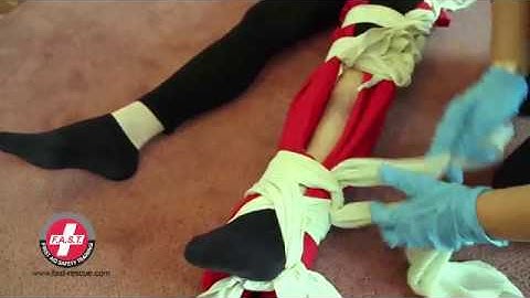 How to treat a Leg Fracture