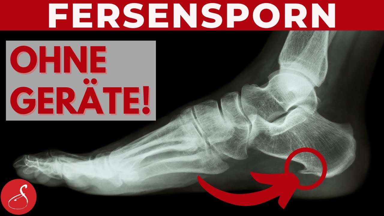 Fersensporn selber richtig Behandeln - Einfache Übungen gegen Fersensporn │ SanoGym