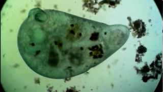Trompetentier Teilung (Stentor, ciliate cell division - amazing video, rare recording)