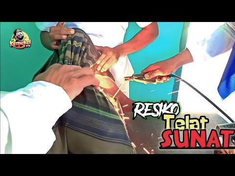 RESIKO TELAT SUNAT‼️| Exstrim Lucu The Series | Funny Videos 2022 | TRY NOT TO LAUGH . KEMEKEL TV