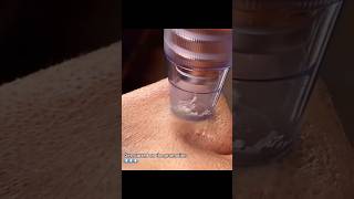 Glow starts with clean pores✨ #ytshorts #review #beautytips #blackheads #whiteheads #skincare
