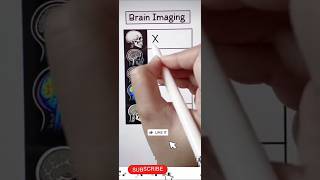 Brain imaging |Different brain images |Name of brain images