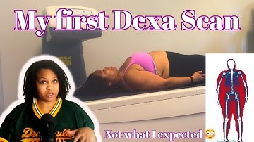 My first DEXA scan and why you should get one too