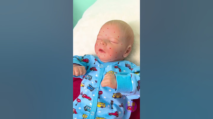 Smart Parenting Trick & Gadget to Keep Mosquitoes Away! 🦟👶✅ #parenting