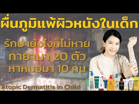 ผื่นภูมิแพ้ผิวหนังในเด็ก คันเรื้อรัง รักษายังไงก็ไม่หาย Atopic Dermatitis in Child