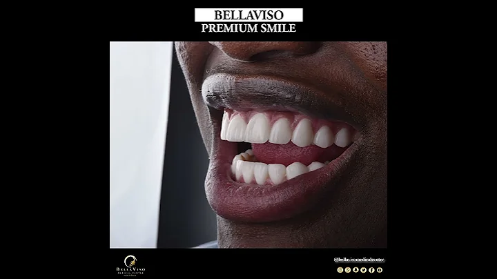 Before & After Smile Makeover Transformations