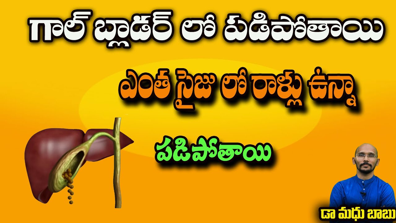 గాల్ బ్లాడర్ లో ఎంత సైజు లో రాళ్లు ఉన్నా పడిపోతాయి| Dr.Madhu Babu Health Trends