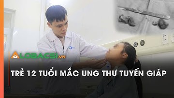 Trẻ 12 tuổi mắc ung thư tuyến giáp | Video Alobacsi