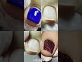 Russian pedicure by MOZHZHERI  ❘  Педикюр MOZHZHERI