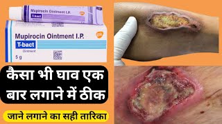 What is T BACT ointment used for? t bact ointment full review in hindi.t bact onitment.