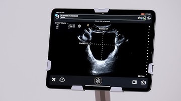 Urinary Bladder Volume