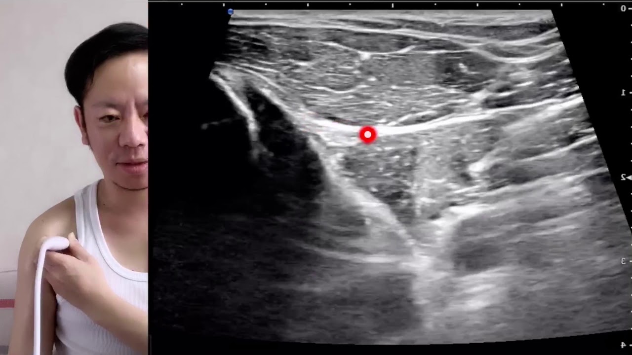 上腕二頭筋サーキット