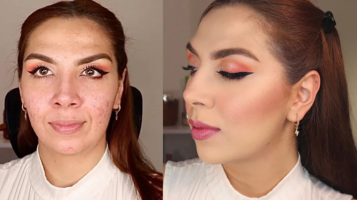 MEJILLAS PERFECTAS en PIEL con ACN y MANCHAS | Ale...