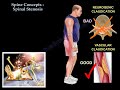 Spinal Stenosis - Everything You Need To Know - Dr. Nabil Ebraheim