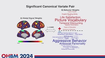 OHBM 2024 | Symposium | Lucina Uddin |  Functional significance of the global signal across the li…