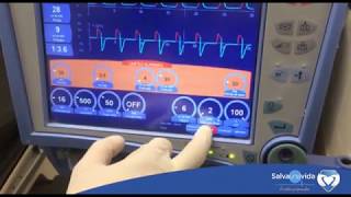 Armado y programación inicial del Ventilador Mecánico Vela