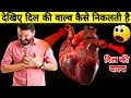 देखिए दिल की वाल्व का ऑपरेशन कैसे होता है || What are heart valves and heart valve disease?
