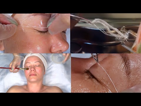 Vídeo: Què és un mini estiratge facial?