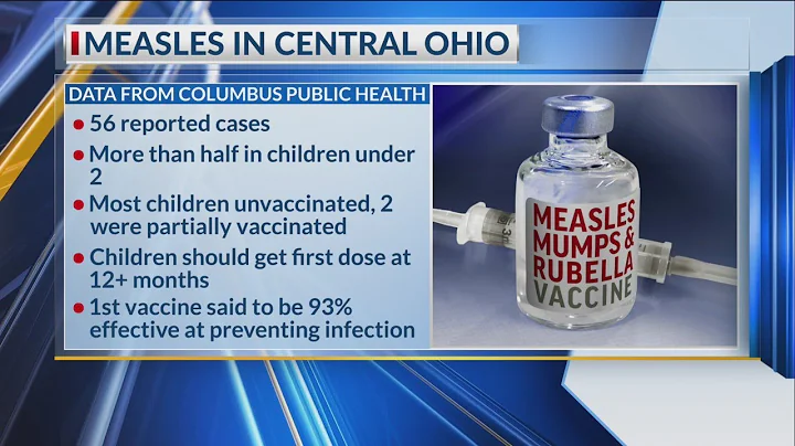Central Ohio measles outbreak spreads to partially vaccinated children