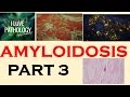 AMYLOIDOSIS: PART 3: Morphology, Diagnosis, Special stains, clinical features & Prognosis