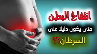 3 علامات تدل على أن انتفاخ البطن | دليل على وجود أمراض خطيرة أهمها السرطان