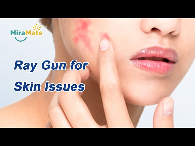 Ray Gun for Skin Issues