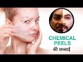 Reality of CHEMICAL PEELS TREATMENT by Healthy Syrus