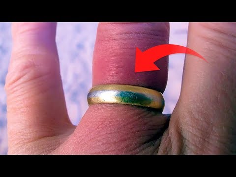 How to Remove a Ring That is Stuck on Your Finger