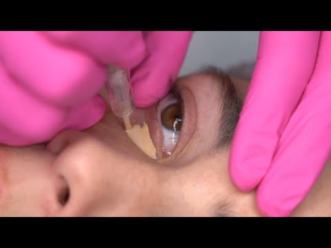 Videó: 3 módszer a Vitiligo foltok sminkkel történő lefedésére