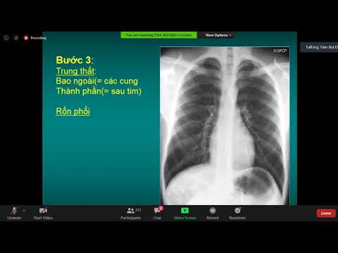 Video: Cách đo thể tích phổi còn lại: 6 bước (có hình ảnh)