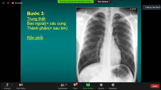 Hướng dẫn đọc X-Quang tim phổi - TS. BS. Phan Thu Phương YHN